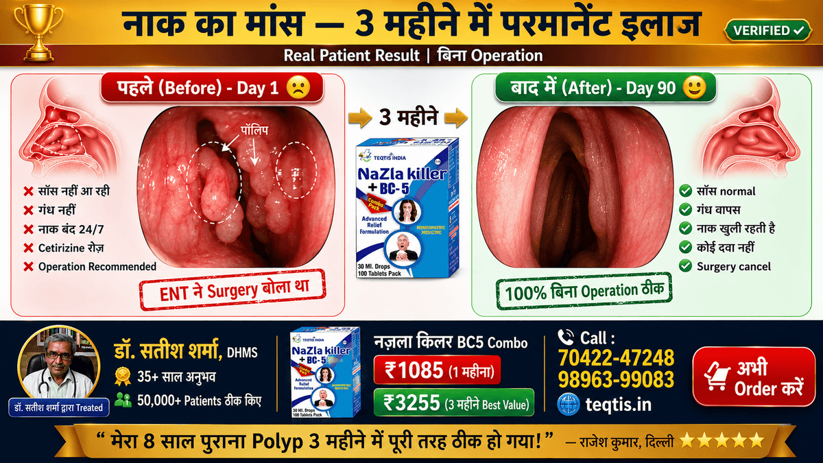 Nazla Killer + BC5 vs बाक़ी सब साइनस पॉलिप नज़ले का #1 Comparison India - Before