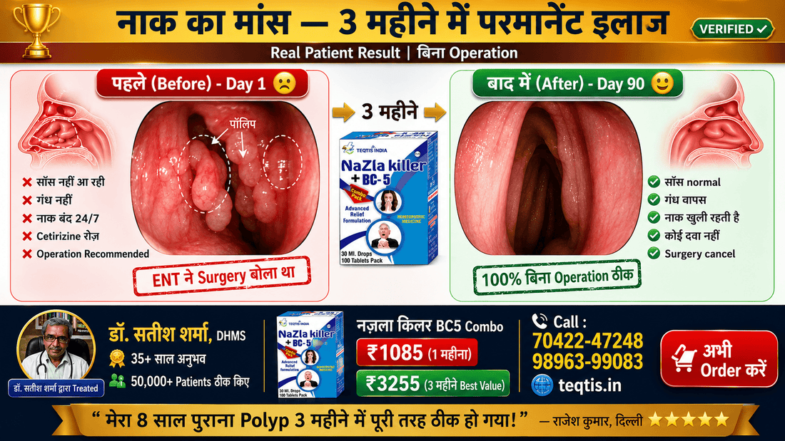 Nazla Killer + BC5 vs बाक़ी सब साइनस पॉलिप नज़ले का #1 Comparison India - Before